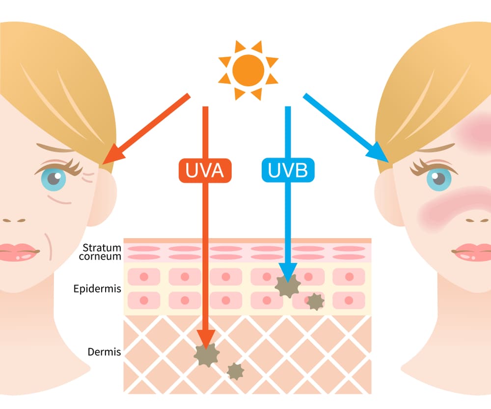 Bức xạ nhiệt là gì? Ảnh hưởng của bức xạ nhiệt 3 Tác động tiêu cực của bức xạ nhiệt